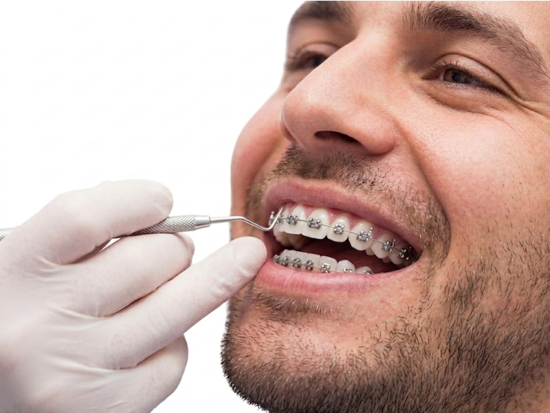 Paciente con brackets metálicos durante revisión de ortodoncia en clínica dental en Valladolid