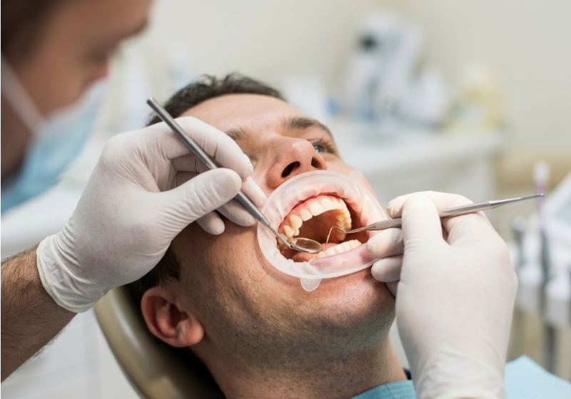 casoscomplejos_SernaDental